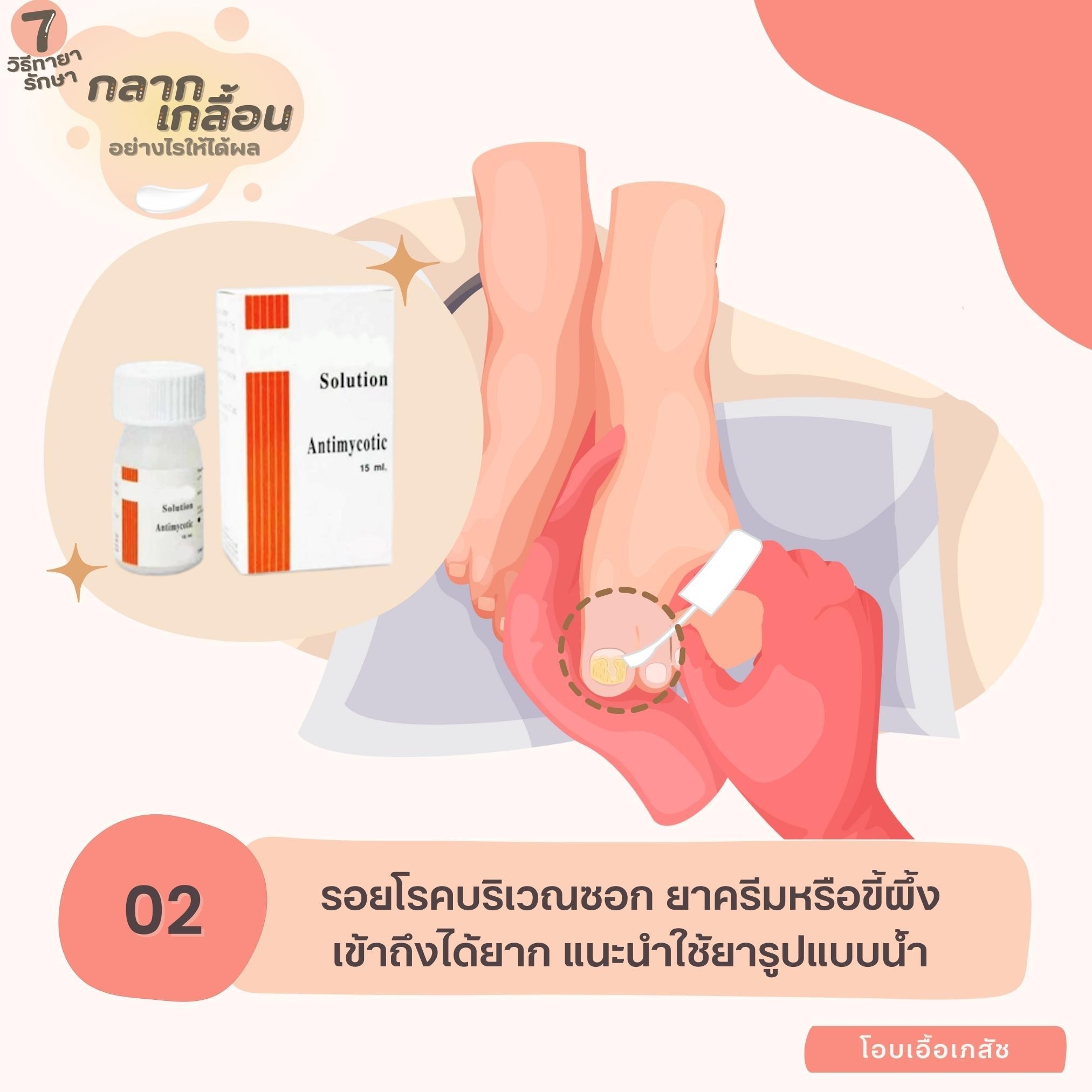 7 วิธีทายากลากเกลื้อนอย่างไรให้ได้ผล-3