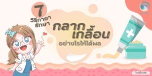 7 วิธีทายากลากเกลื้อนอย่างไรให้ได้ผล