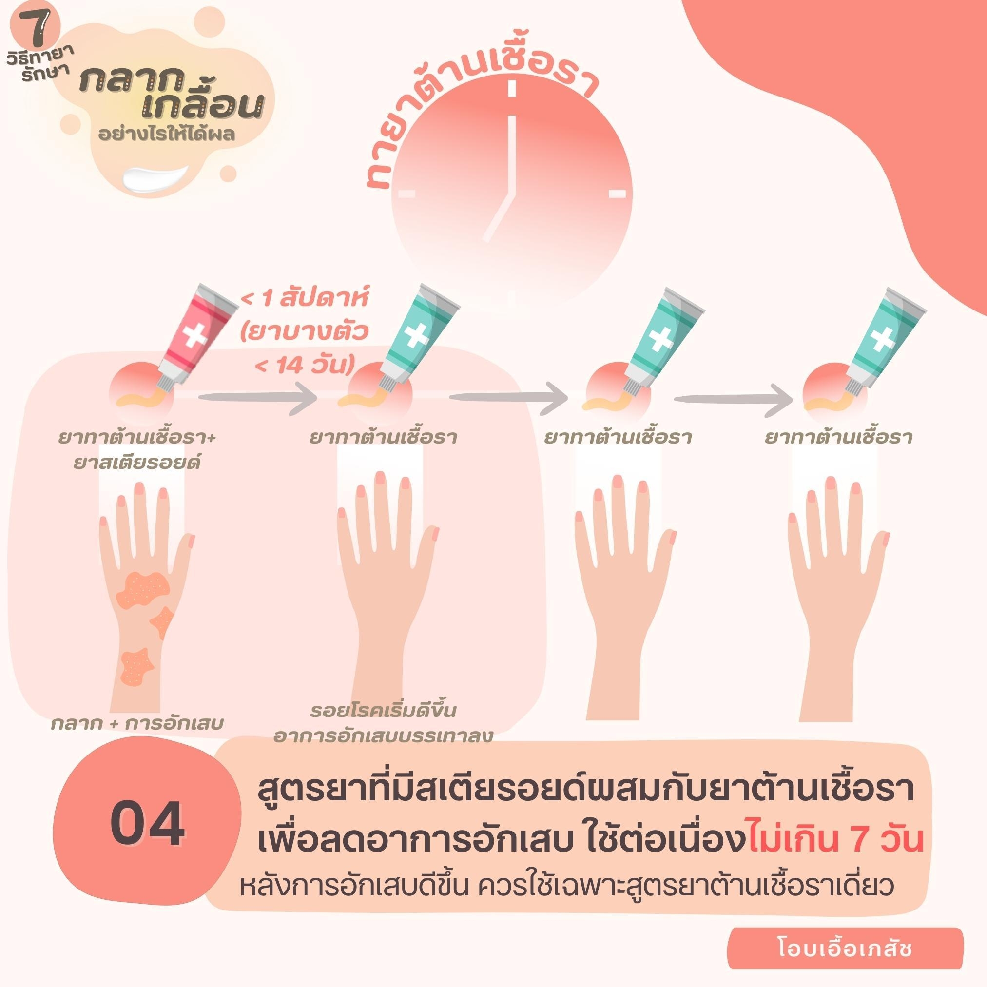 7 วิธีทายากลากเกลื้อนอย่างไรให้ได้ผล-5