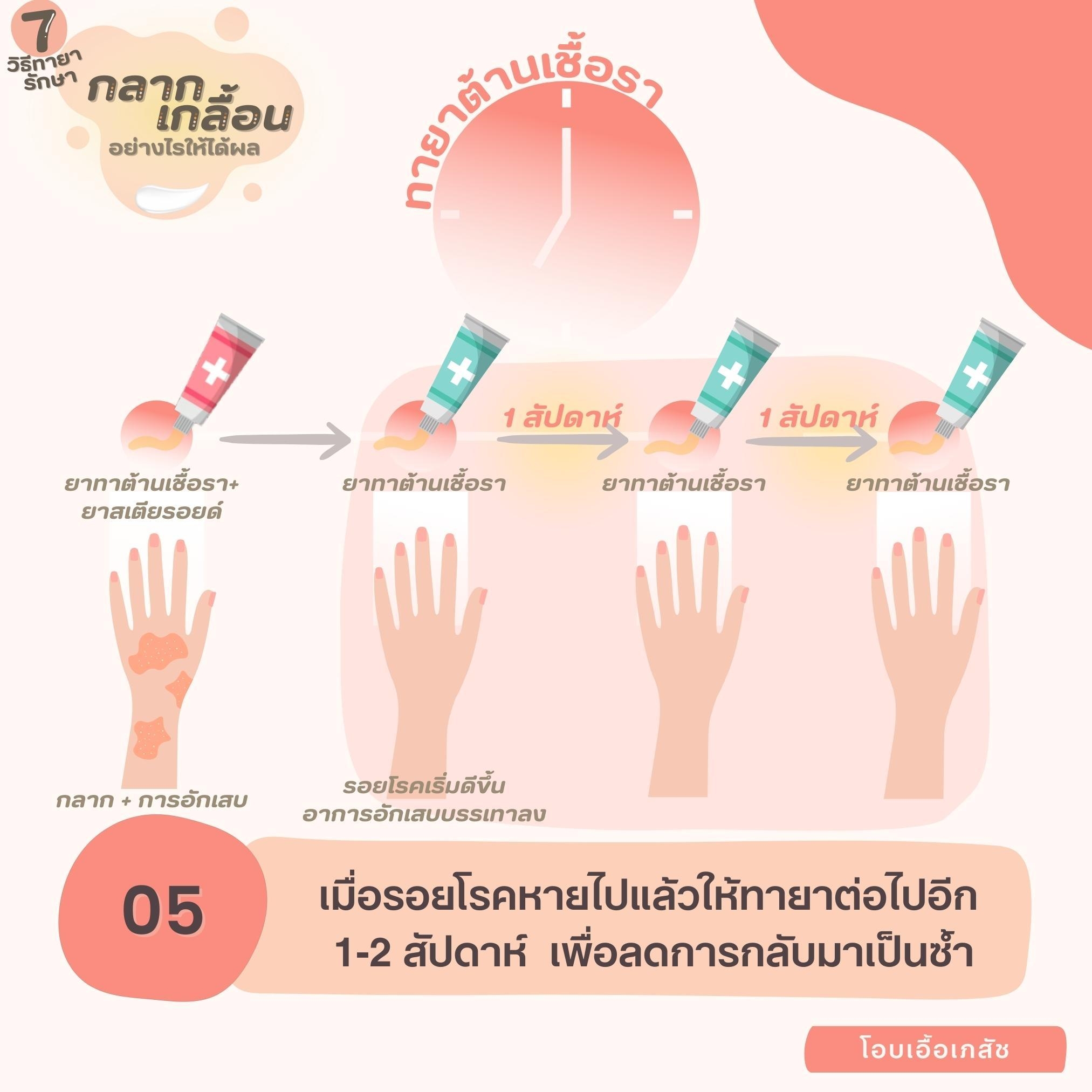 7 วิธีทายากลากเกลื้อนอย่างไรให้ได้ผล-6