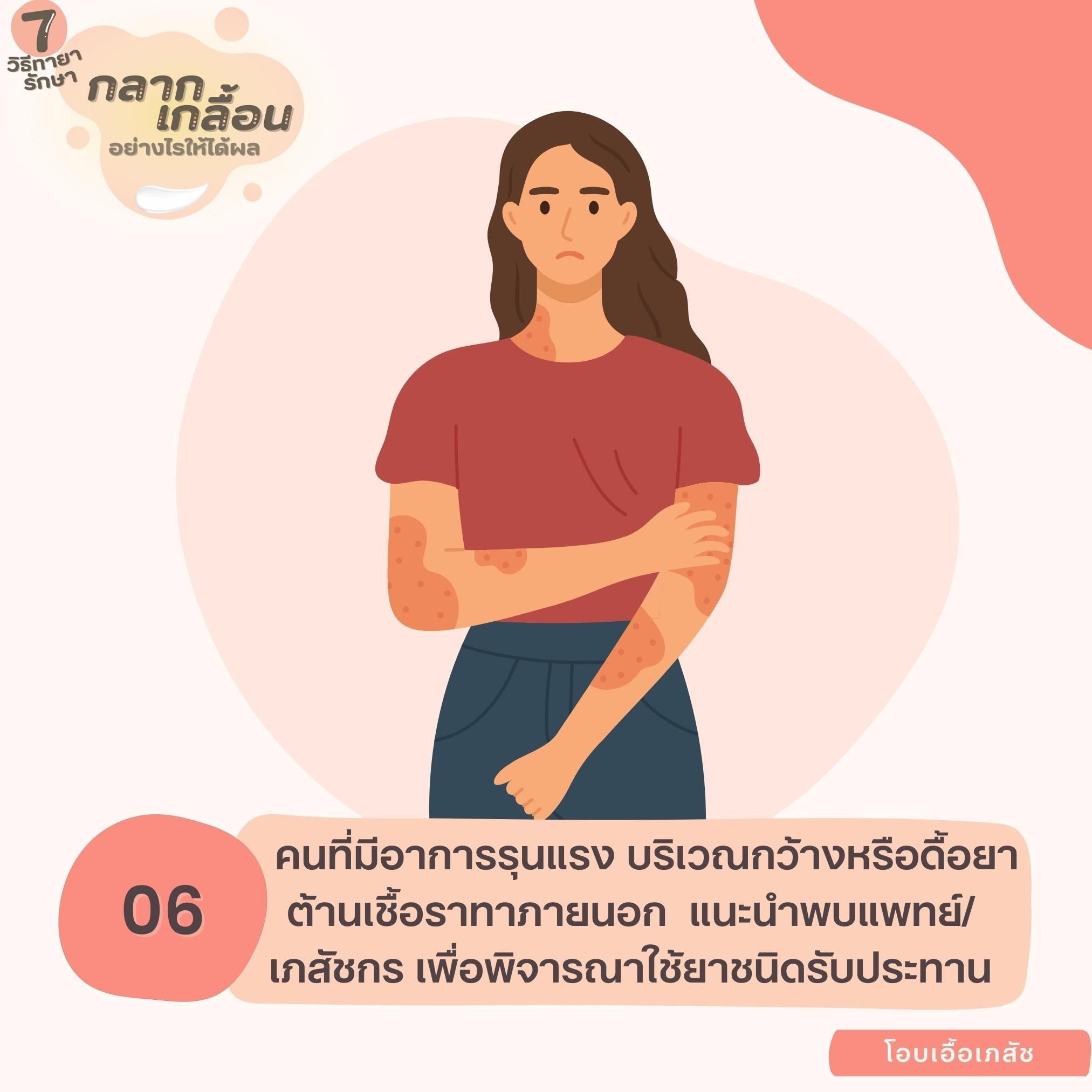 7 วิธีทายากลากเกลื้อนอย่างไรให้ได้ผล-7